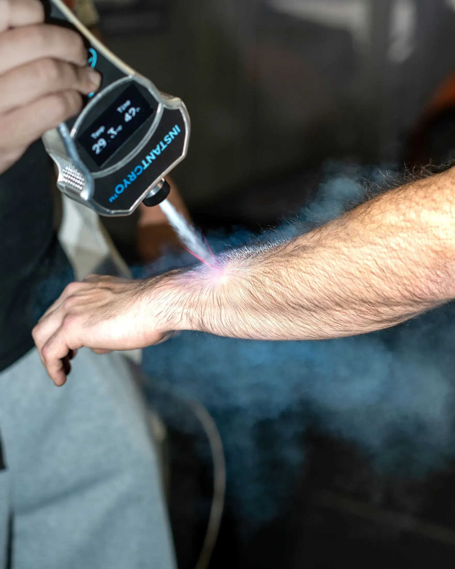 InstantCryo device spraying cold vapor on an arm